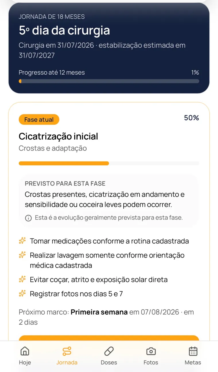 Tela Jornada do Up Hair com a fase atual e o próximo marco da jornada de 18 meses