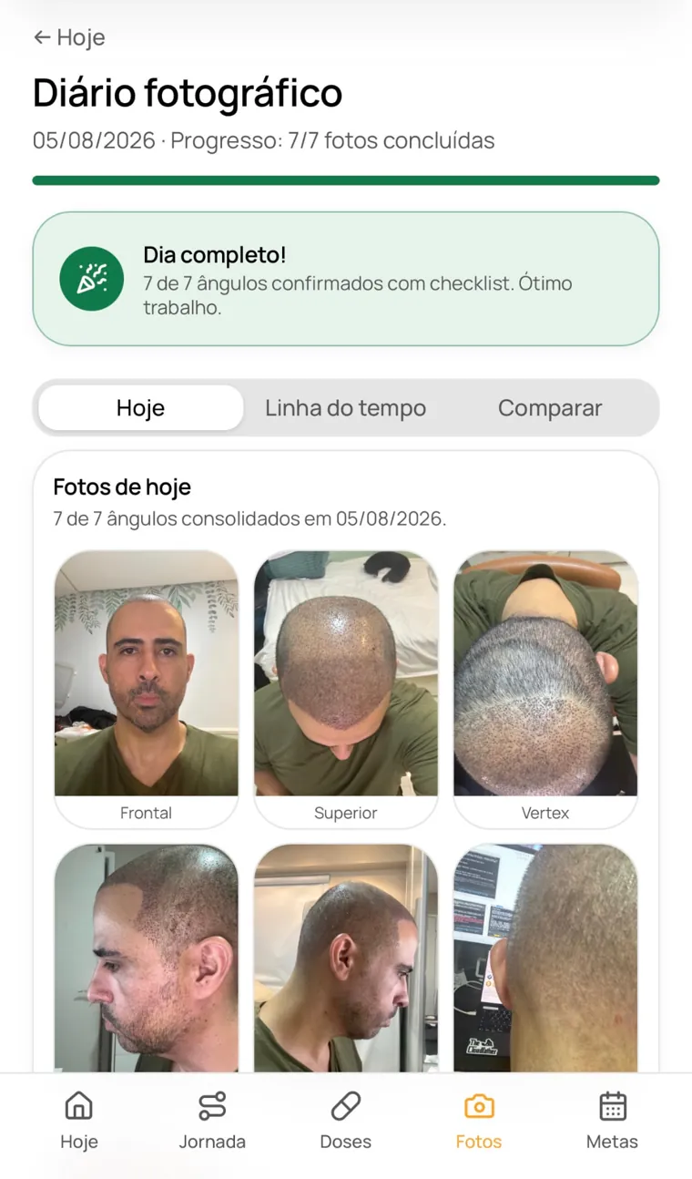 Tela Diário fotográfico do Up Hair com os 7 ângulos registrados no dia